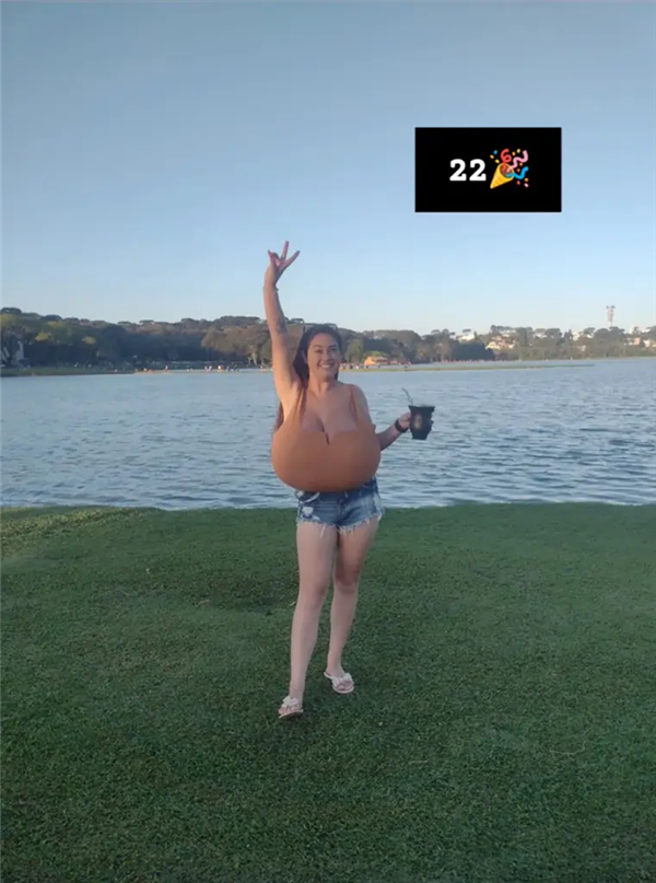 巴西女子患“巨乳症”失控！短短几月长O杯 出行得坐轮椅