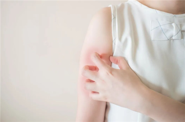 没伤口却疼得像针扎 揭秘皮肤突发刺痛的常见诱因