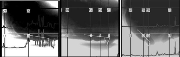 上厕所 坐着好还是蹲着好？最佳姿势竟然是……