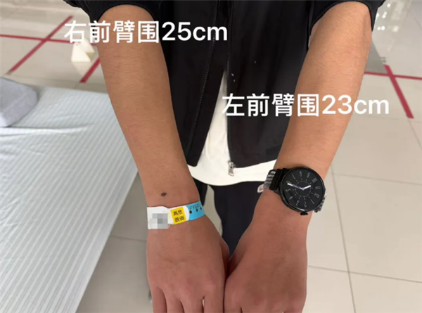 高中生左手莫名发抖半年确诊平山病：长期保持错误坐姿
