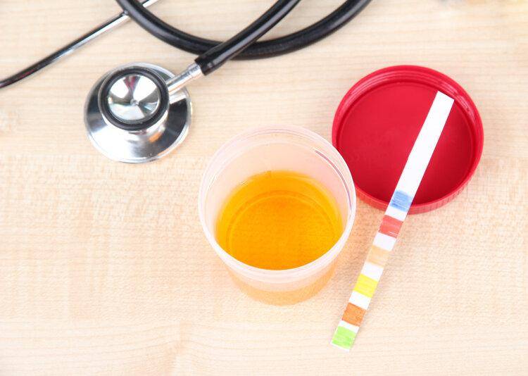 男人晨起，上厕所没出现这5种现象，那么恭喜你的肾还很健康