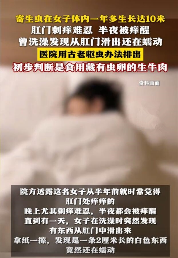 女子体内排出10米长寄生虫:或与食用生牛肉有关